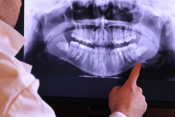 Best Emergency Broken Tooth Repair in Westminster, CA